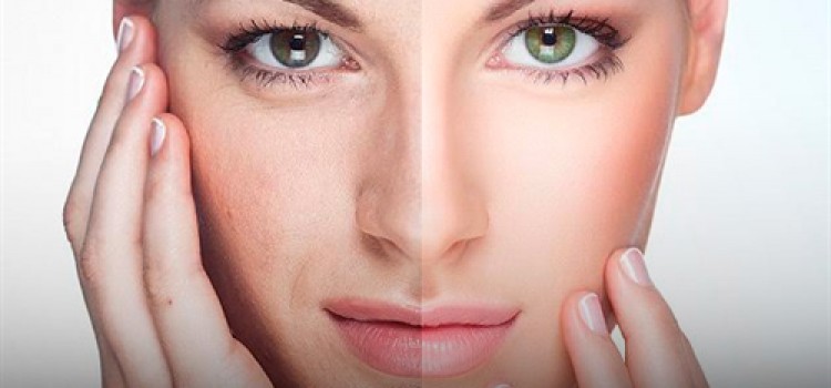 Harmonização Facial - Aliado ao rejuvenescimento